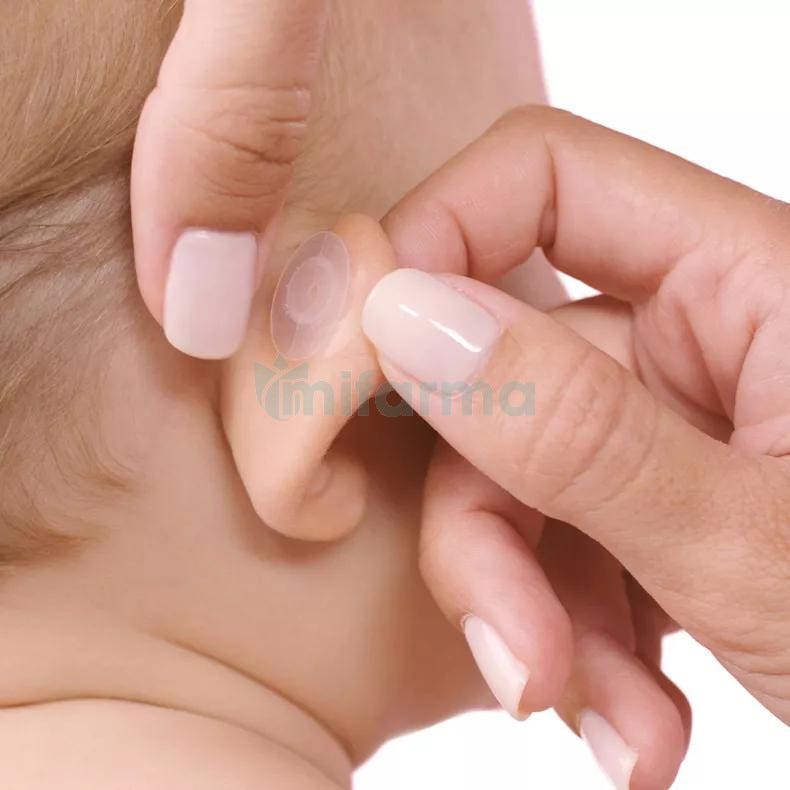Otostick Baby 3 Pack - Otostick USA | Aesthetic Ear Corrector